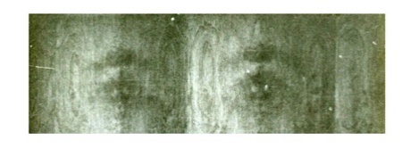 Image result for Jesus' face at Walker County Medical Center in Jasper, Alabama